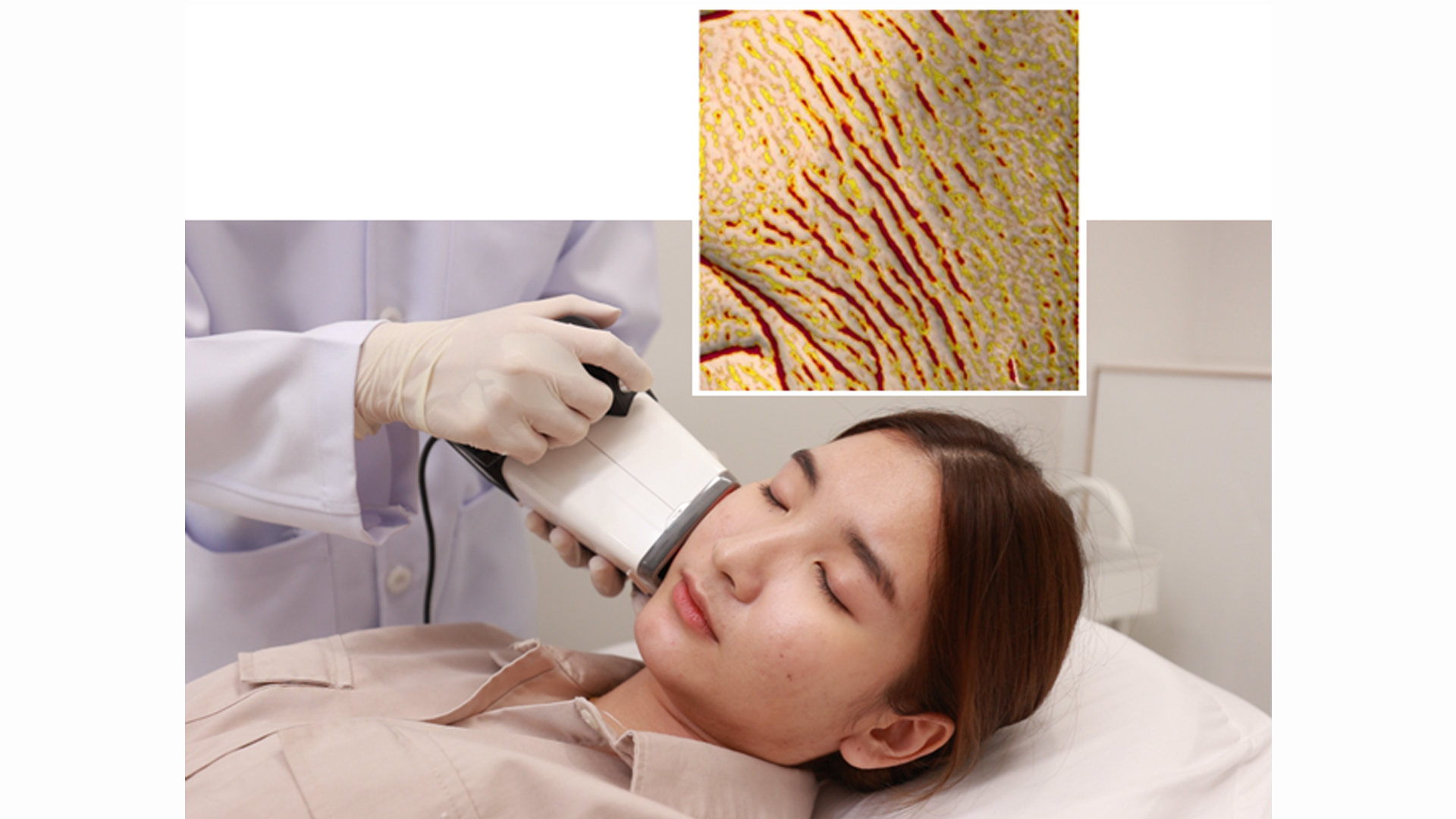 SKIN ANTI-AGING (ANTI-WRINKLES TEST)